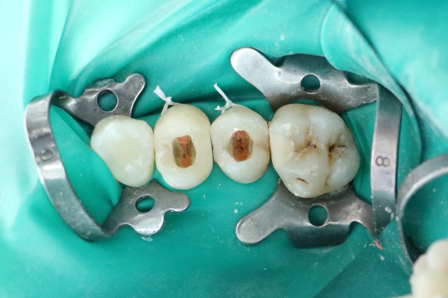 Endodontia na Clínica Pedral