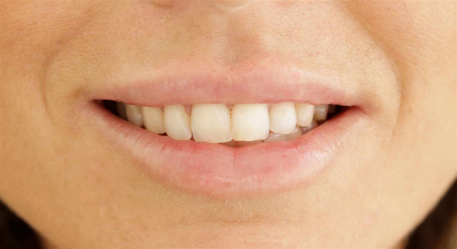Harmonização Facial na Clínica Pedral