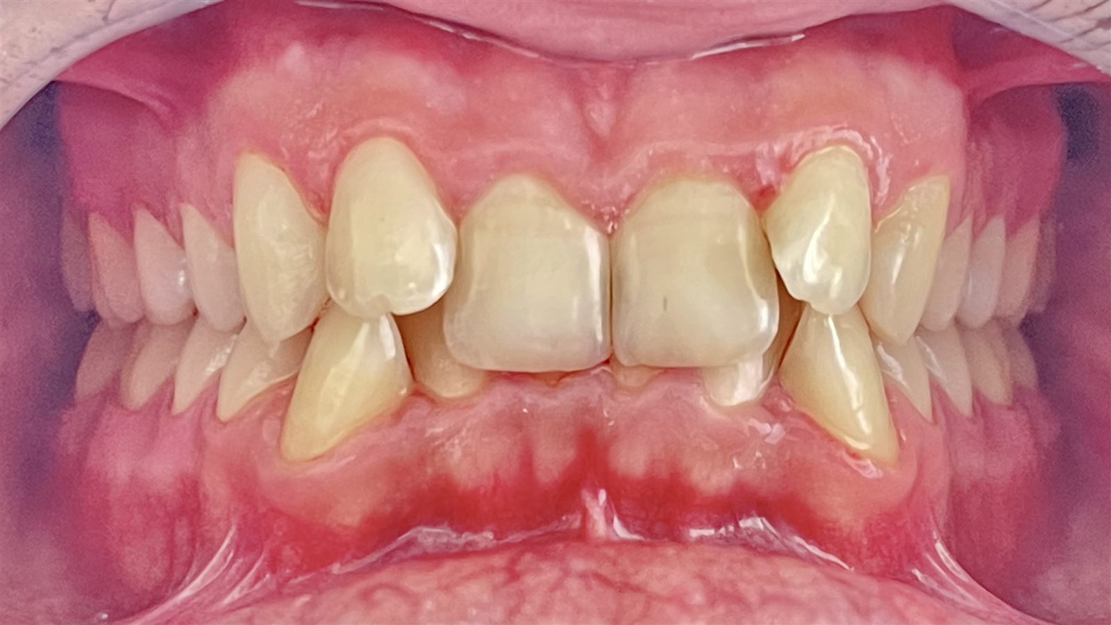 Higiene Oral na Clínica Pedral