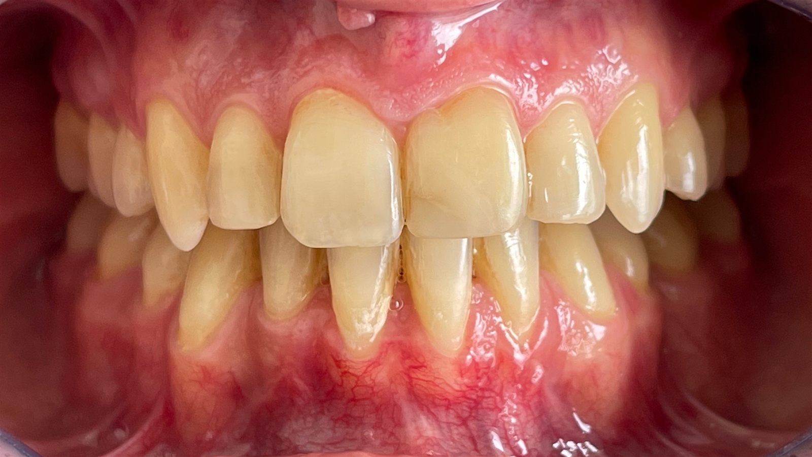 Periodontia na Clínica Pedral